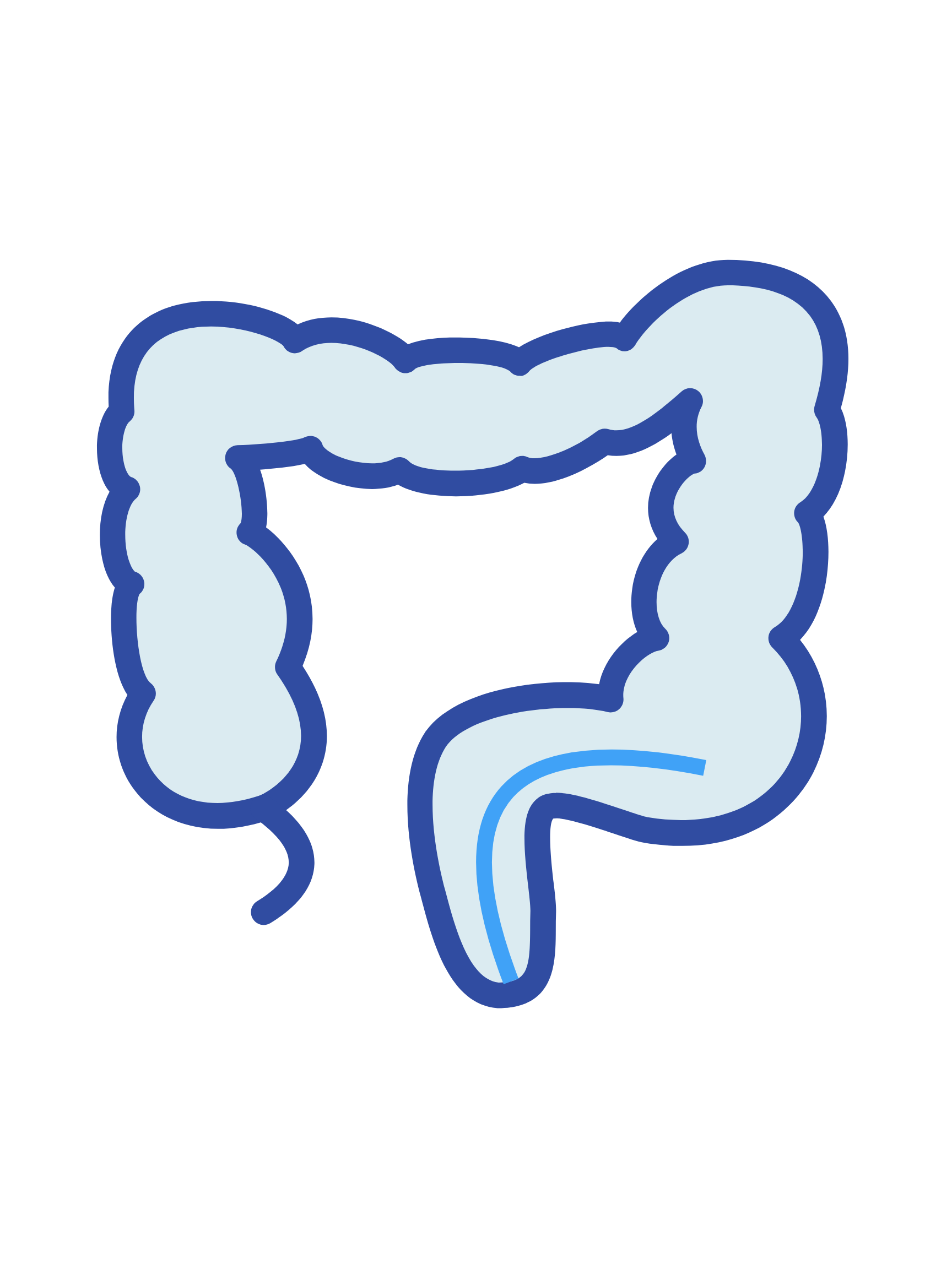 Flexible Sigmoidoscopy
